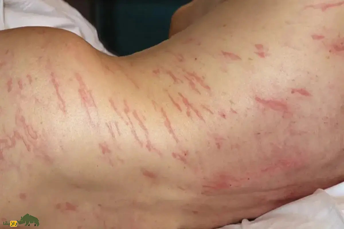 ۱۲ مورد پزشکی عجیب ۲۰۲۵؛ از سندروم زبان خارجی و بارداری نادر از طریق رابطه دهانی تا جراحی دندان در چشم و آلرژی‌های غیرقابل باور بدن انسان