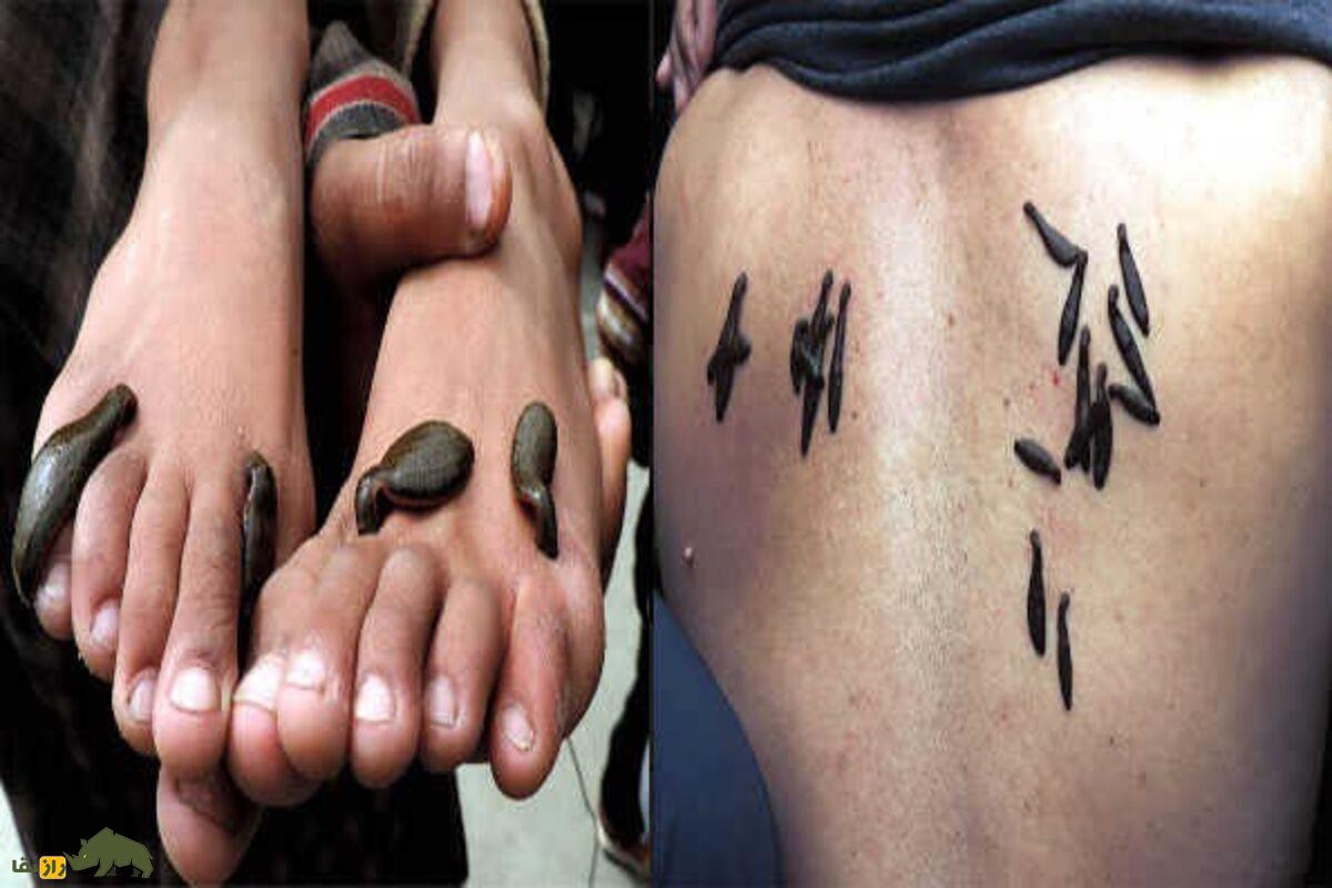 زالو؛ موجودی با ۳۲ مغز، ۱۰ معده و ۹ جفت بیضه | پشت‌پرده‌ی عجایب بدنی این کرم درمانگر